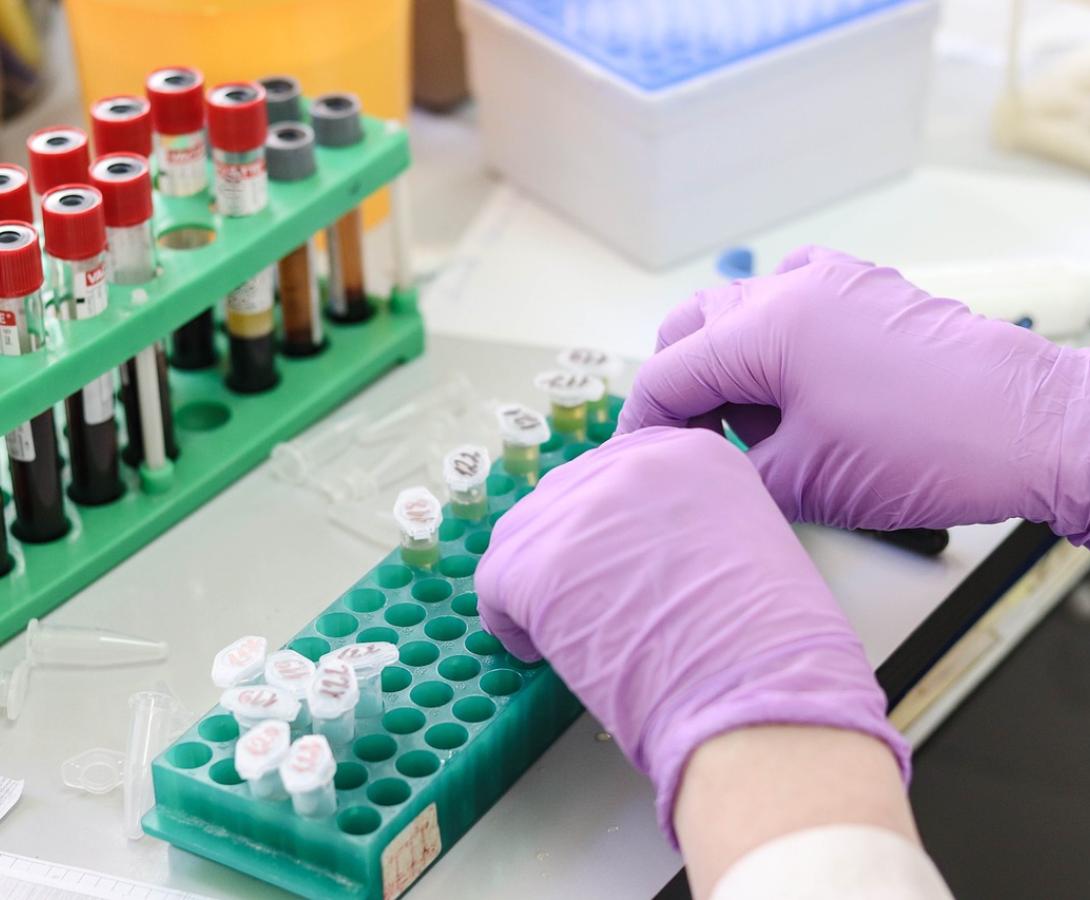 blood test image